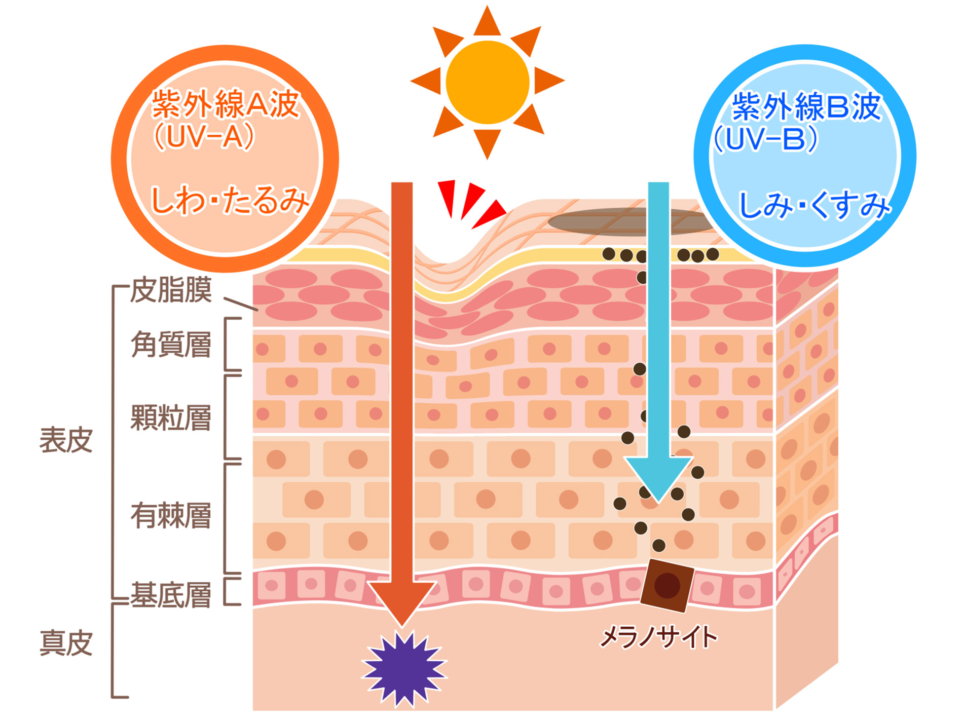 紫外線の肌影響