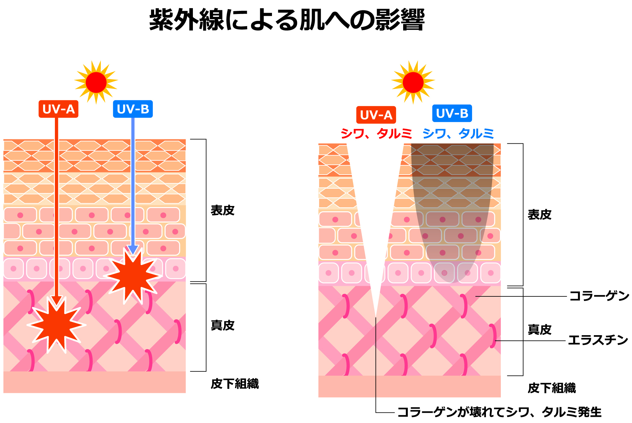 紫外線による肌への影響