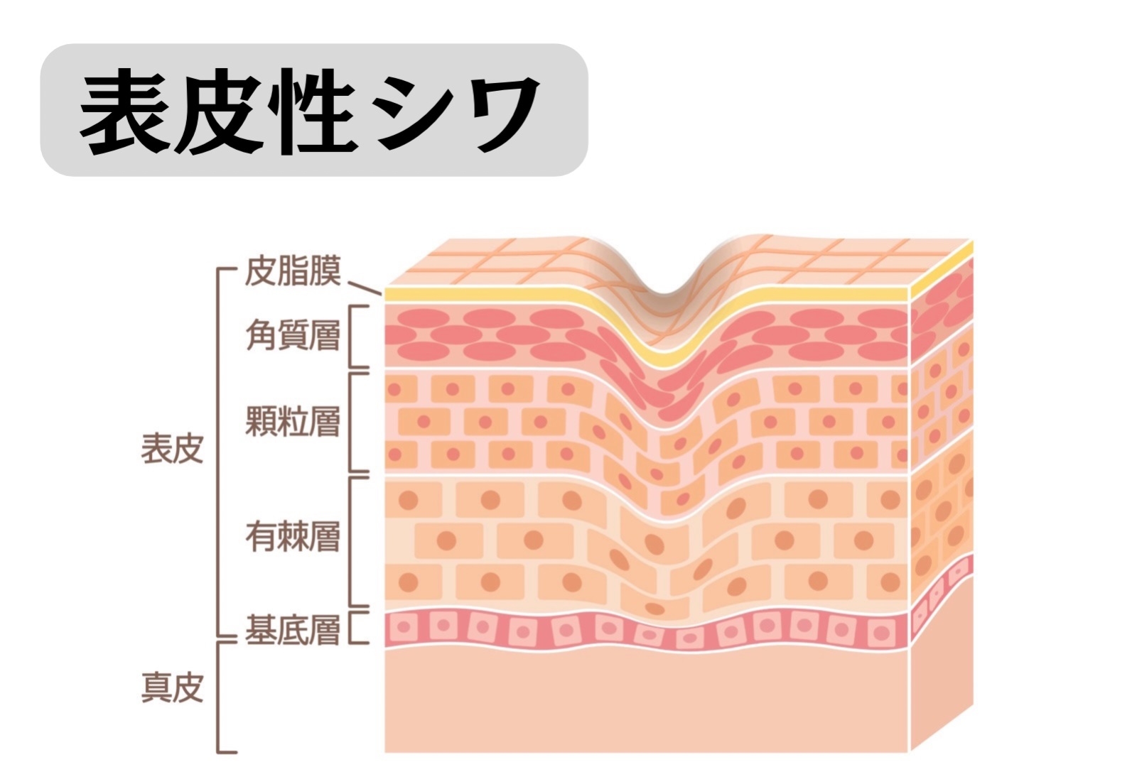 表皮性シワのイメージ