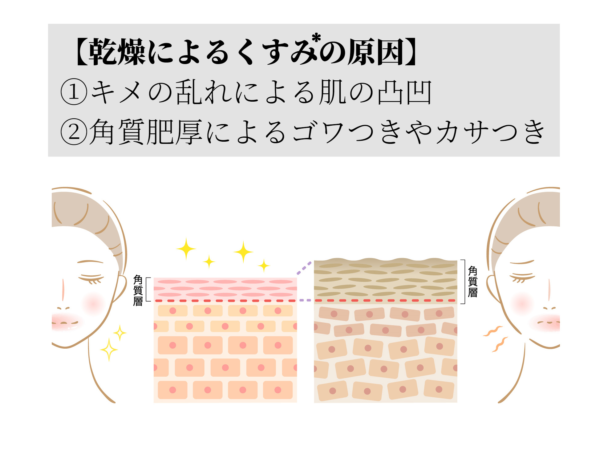 乾燥によるくすみ*の原因