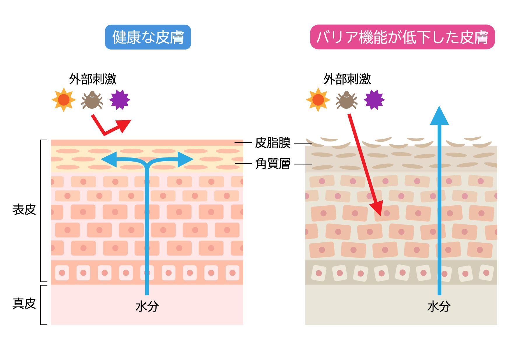 健康的な皮膚とバリア機能が低下した皮膚の違い
